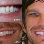 smile 3