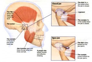tmd-treatment